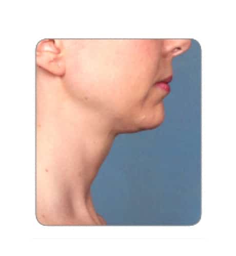 After Image: Case 2