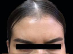 After Image: Case 9 - front