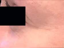 After Image: Case 13