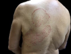 Before Image: Case 33