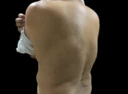 After Image: Case 33