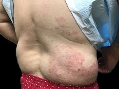 Before Image: Case 35