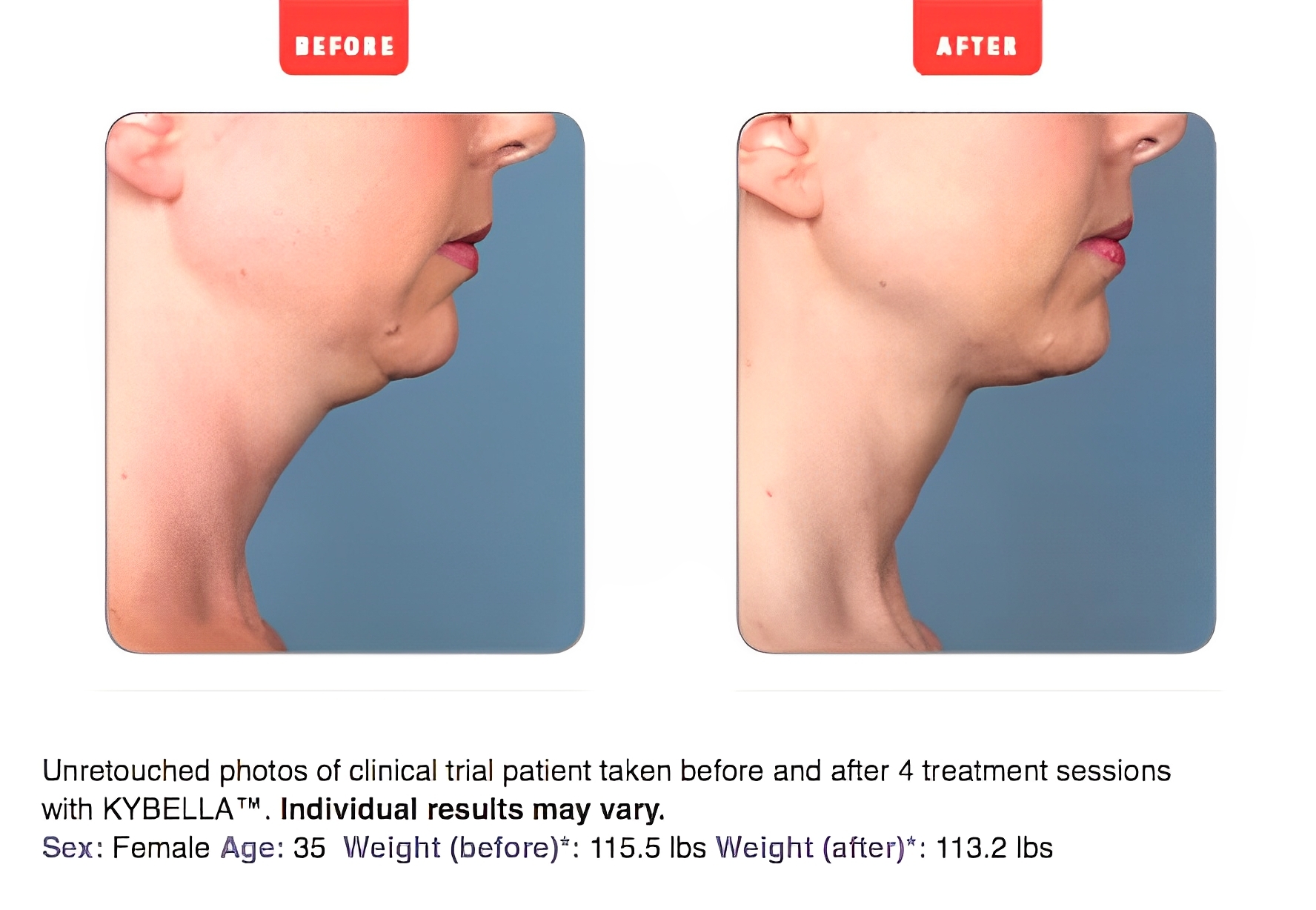 derm image2(1)