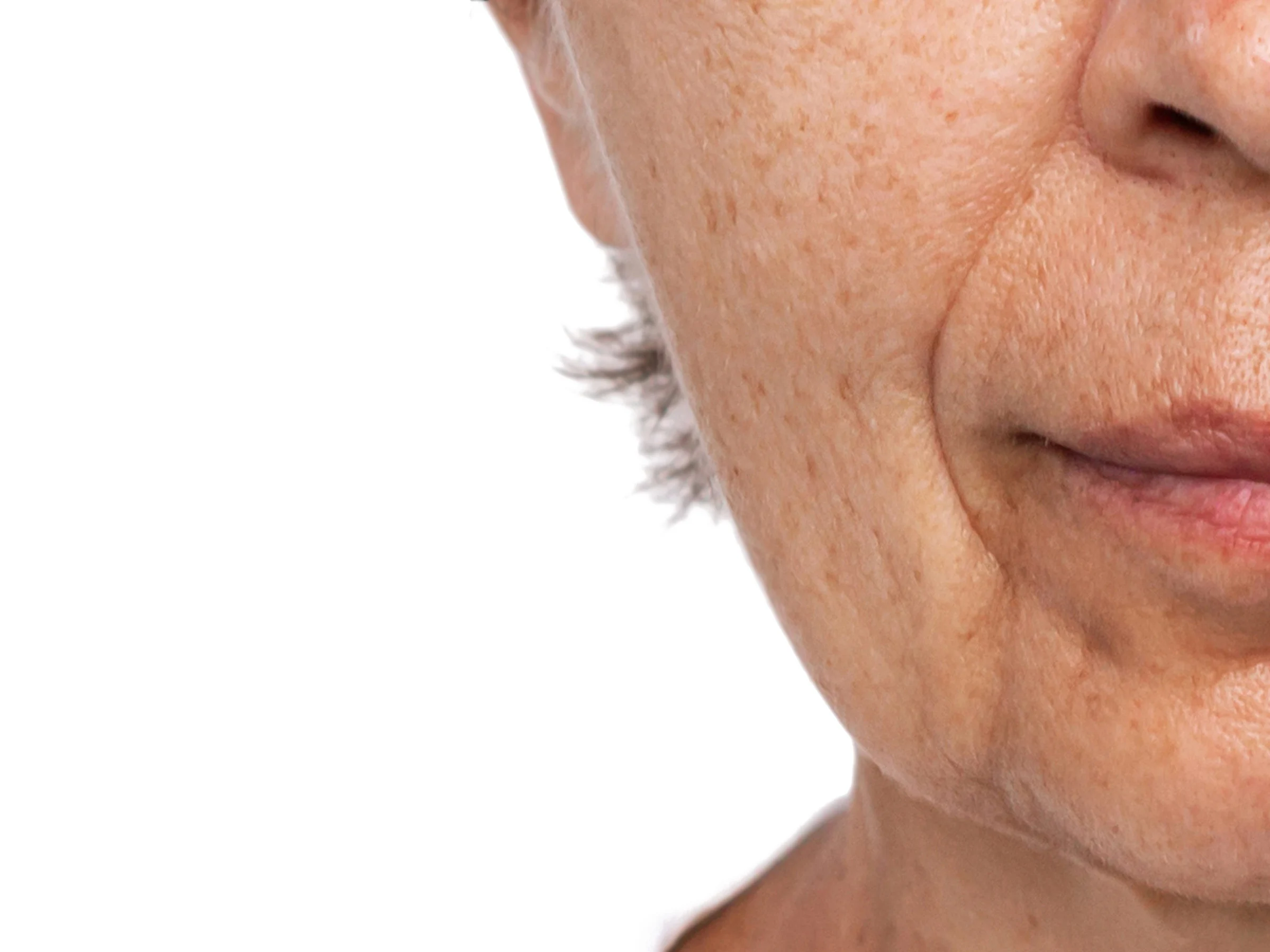 Close-up of the lower face showing sagging skin along the jawline and deep folds beside the mouth