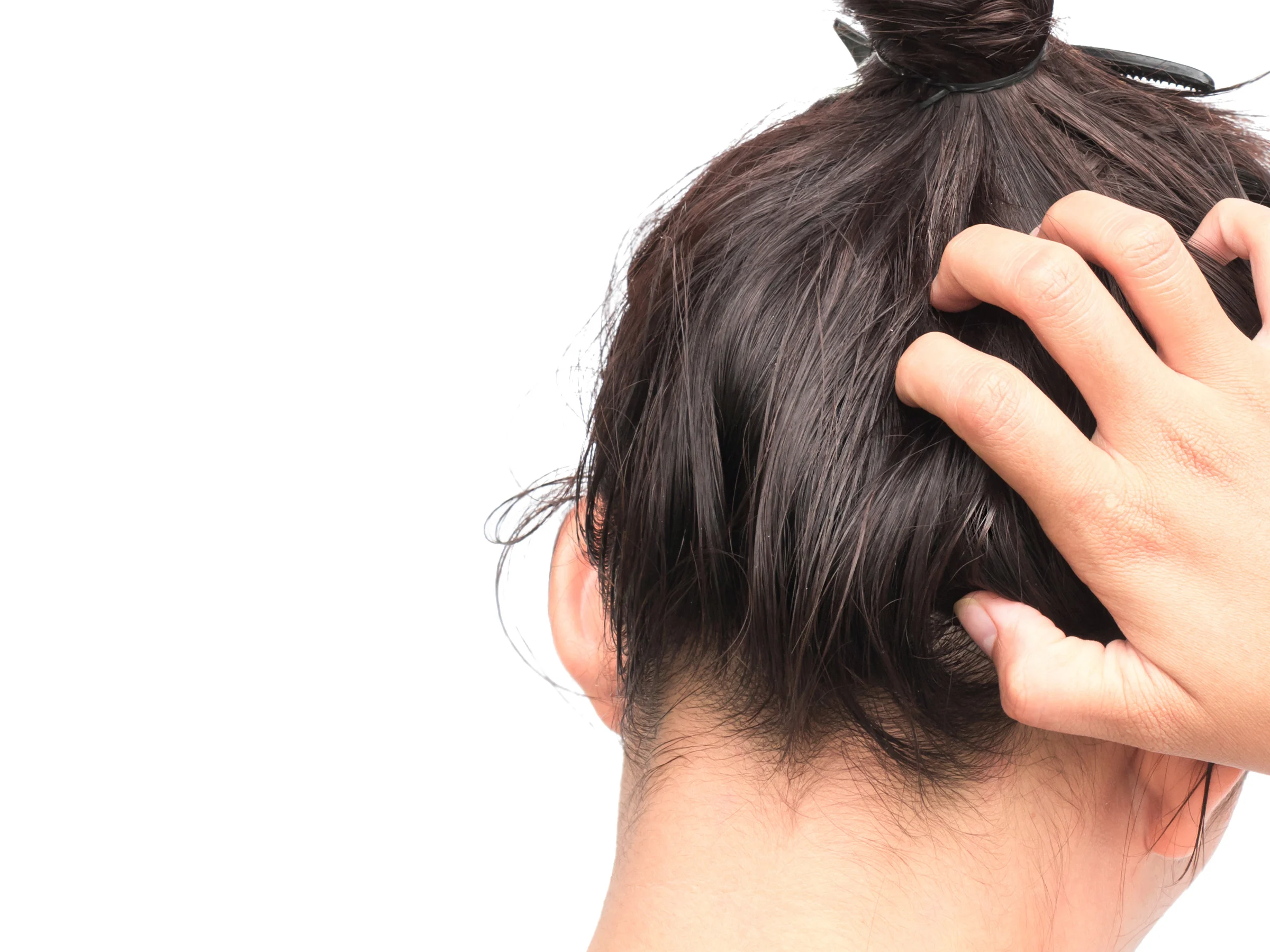 A person scratching an itchy scalp