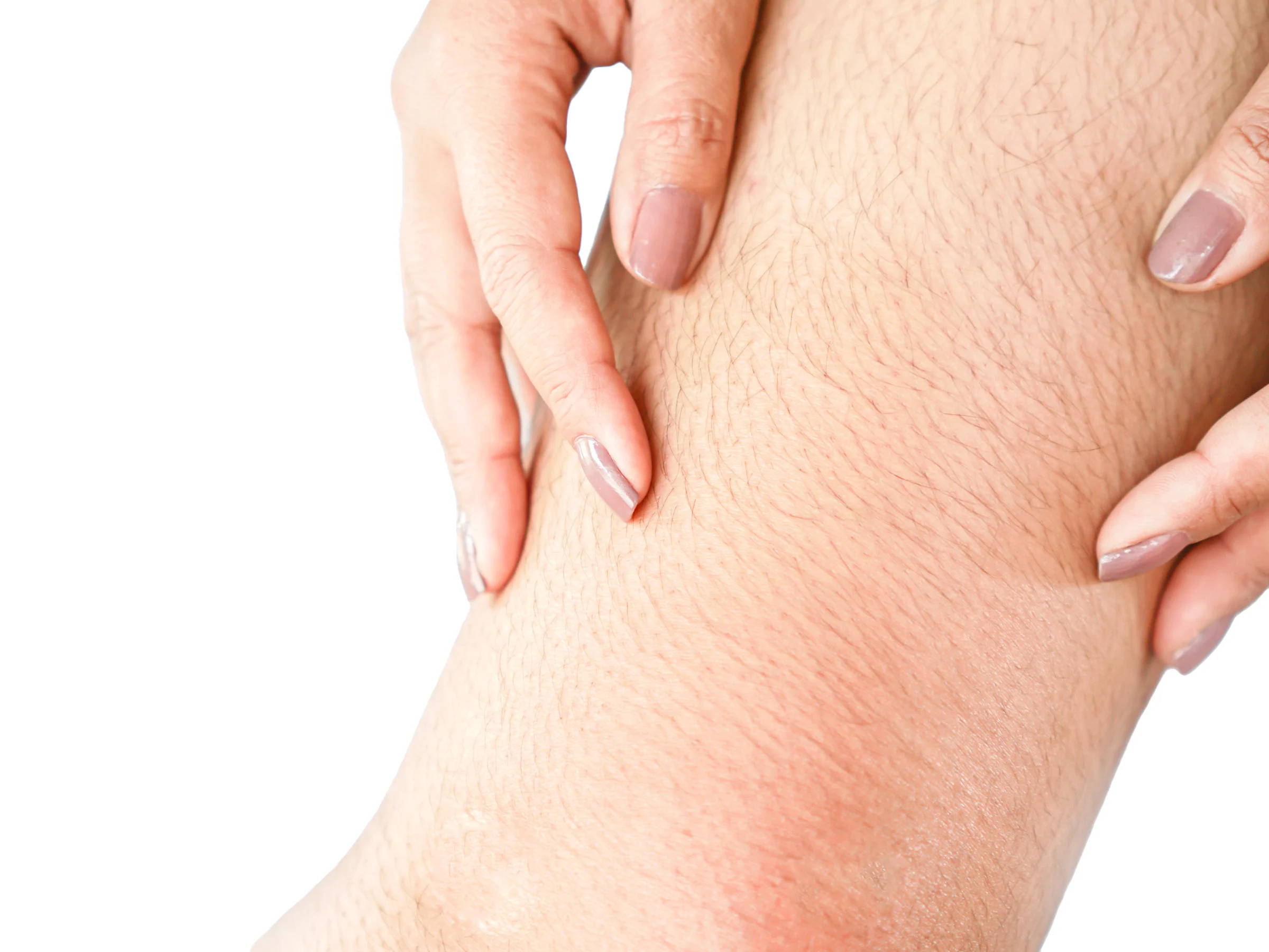 Close-up of hands on a leg with visible unwanted hair